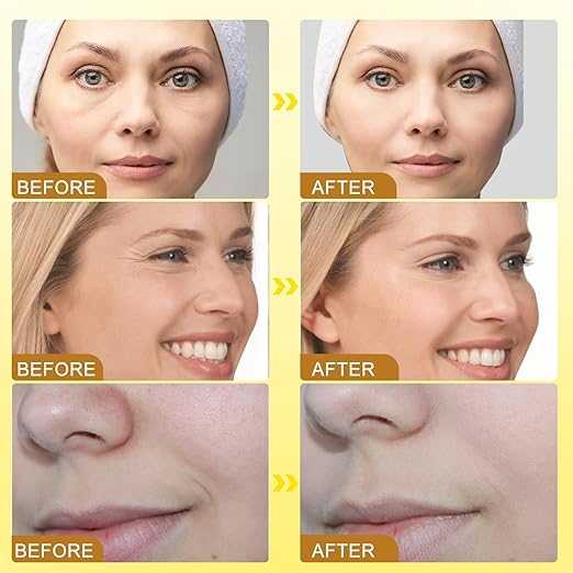 Botox Bee Venom Cream  (كريم البوتوكس بسمّ النحل)